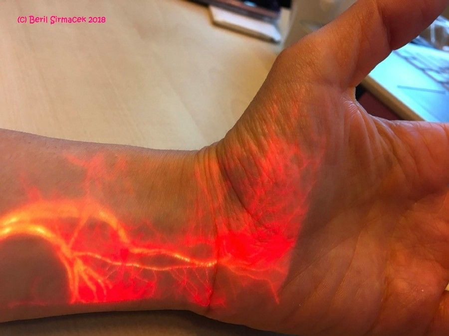 Figure 1. Augmented reality visualization of blood flow in the wrist and hand.