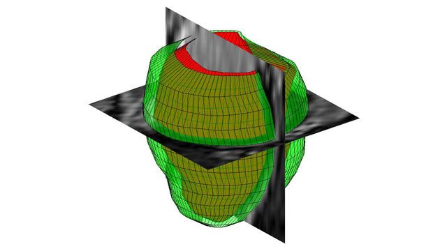 Procesamiento de imágenes 3D