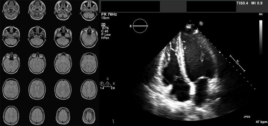 Ejemplos de imágenes en formato DICOM: serie de 20 imágenes de una IRM de un cerebro y una imagen de ecocardiografía.