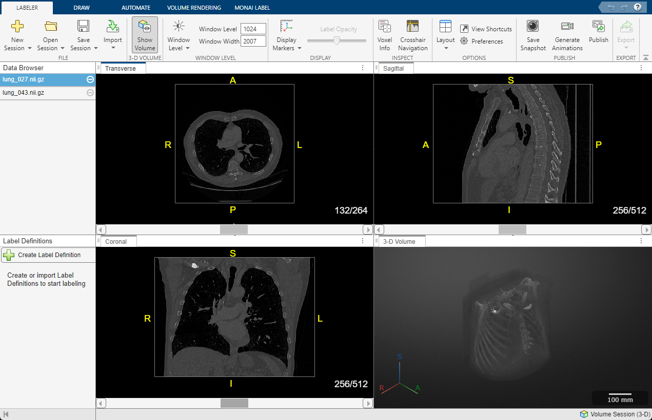 Imágenes DICOM transversales, sagitales, coronales y de volumen en 3D de una TC torácica con etiquetas.