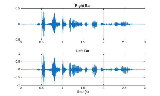 Figure contains 2 axes objects. Axes object 1 with title Right Ear contains an object of type line. Axes object 2 with title Left Ear, xlabel time (s) contains an object of type line.