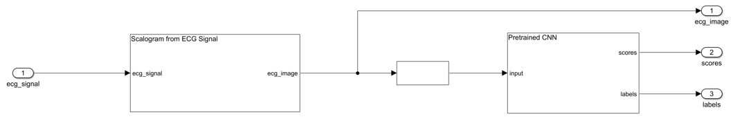 Code Generation for a Deep Learning Simulink Model to Classify ECG Signals