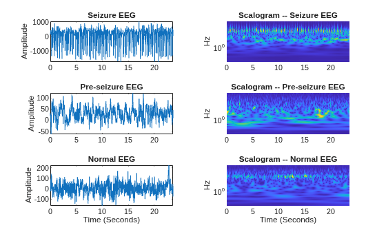 Figure contains 6 axes objects. Axes object 1 with title Seizure EEG, ylabel Amplitude contains an object of type line. Axes object 2 with title Scalogram -- Seizure EEG, ylabel Hz contains an object of type surface. Axes object 3 with title Pre-seizure EEG, ylabel Amplitude contains an object of type line. Axes object 4 with title Scalogram -- Pre-seizure EEG, ylabel Hz contains an object of type surface. Axes object 5 with title Normal EEG, xlabel Time (Seconds), ylabel Amplitude contains an object of type line. Axes object 6 with title Scalogram -- Normal EEG, xlabel Time (Seconds), ylabel Hz contains an object of type surface.