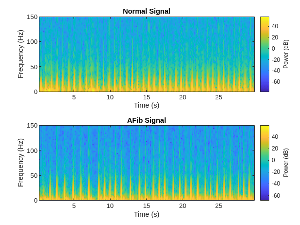 Classify ECG Signals Using Long Short-Term Memory Networks