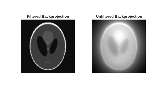 Figure contains 2 axes objects. Hidden axes object 1 with title Filtered Backprojection contains an object of type image. Hidden axes object 2 with title Unfiltered Backprojection contains an object of type image.