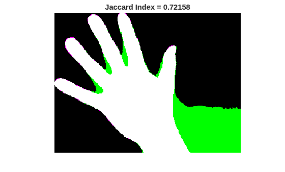 Figure contains an axes object. The hidden axes object with title Jaccard Index = 0.72158 contains an object of type image.