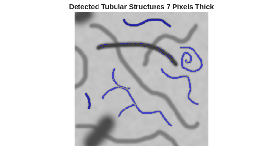 Figure contains an axes object. The hidden axes object with title Detected Tubular Structures 7 Pixels Thick contains an object of type image.