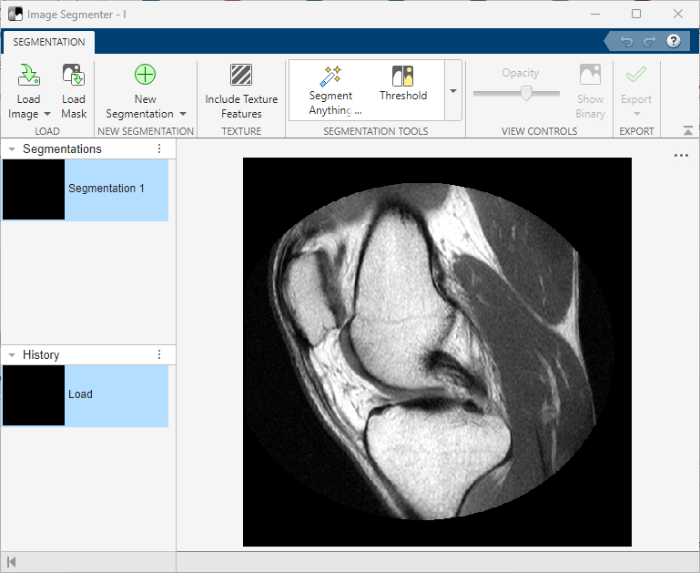 Image Segmenter app showing a scan of a human knee.