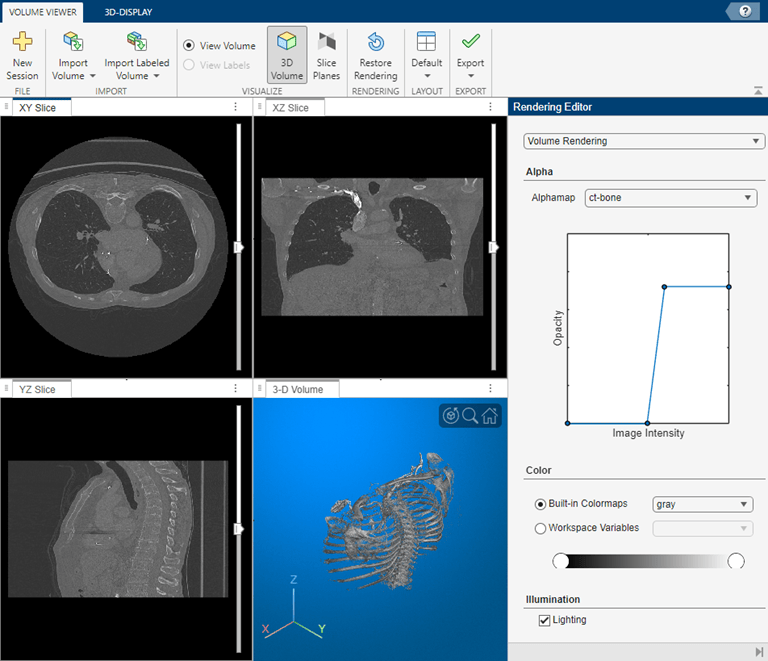 Volume in Volume Viewer with the ct-bone alphamap.