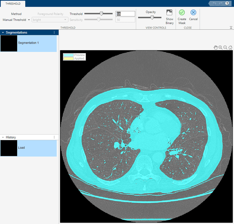 Image Segmenter displaying the Threshold tab and a preview of the thresholded region over the volume.