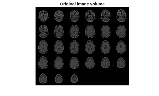 Figure contains an axes object. The hidden axes object with title Original image volume contains an object of type image.