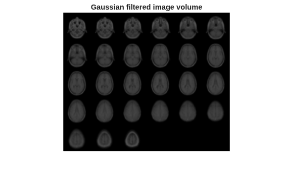 Figure contains an axes object. The hidden axes object with title Gaussian filtered image volume contains an object of type image.