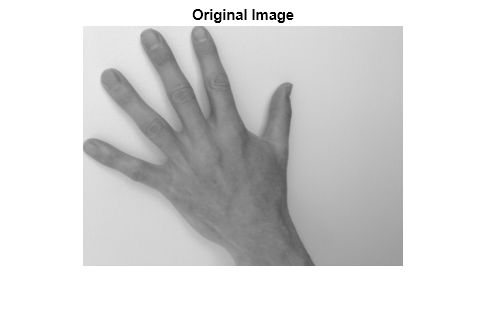 Figure contains an axes object. The hidden axes object with title Original Image contains an object of type image.