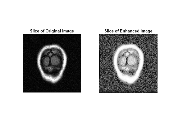 Figure contains 2 axes objects. Hidden axes object 1 with title Slice of Original Image contains an object of type image. Hidden axes object 2 with title Slice of Enhanced Image contains an object of type image.