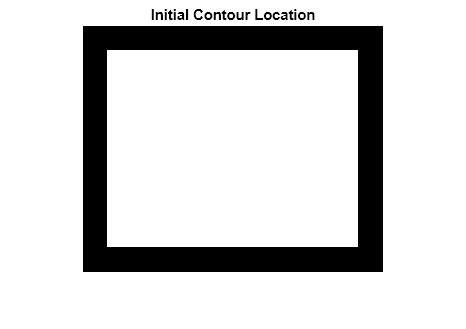 Figure contains an axes object. The hidden axes object with title Initial Contour Location contains an object of type image.