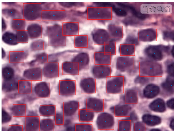 Detect Nuclei in Large Whole Slide Images Using Cellpose