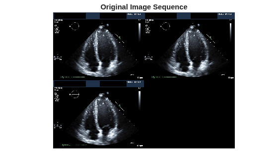 Figure contains an axes object. The hidden axes object with title Original Image Sequence contains an object of type image.