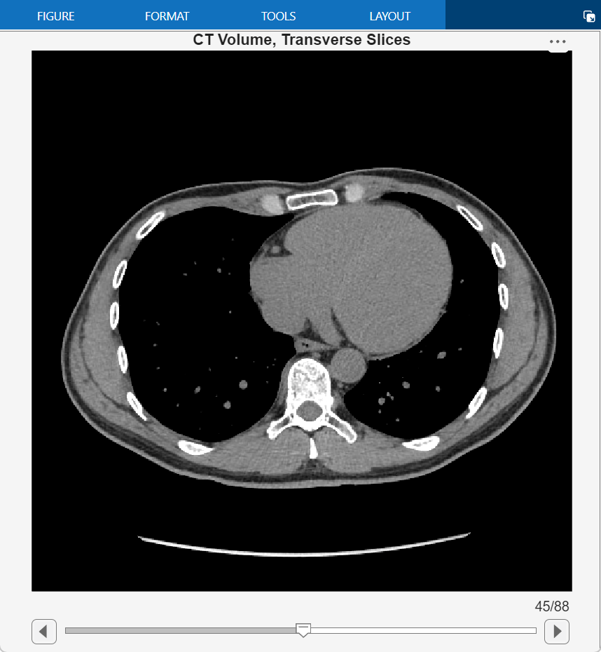 Read, Process, and Write 3-D Medical Images
