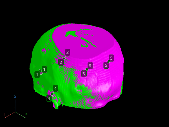 Register 3-D Multimodal Medical Image Volumes Using Anatomical Landmarks