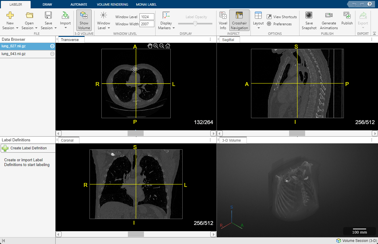 Medical Image Labeler app volume session with crosshairs navigation turned on