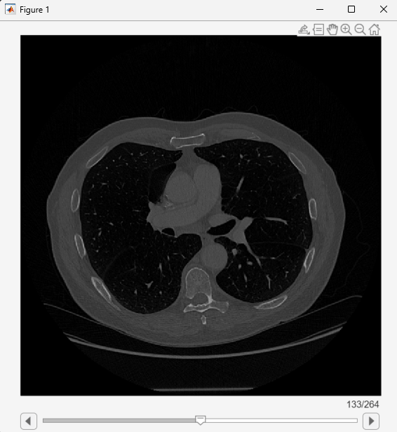 Slice viewer window, showing transverse slices in a scrollable figure window
