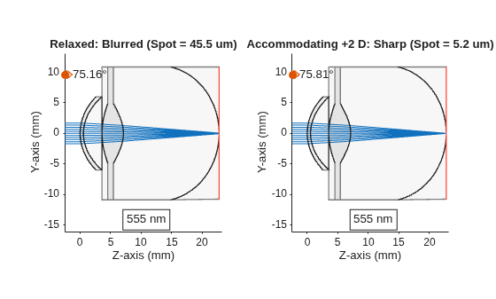 Model Human Eye Diopters, Accommodation, and Refractive Errors