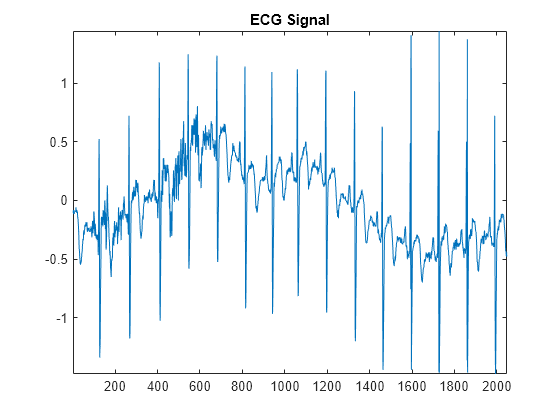 Figure contains an axes object. The axes object with title ECG Signal contains an object of type line.