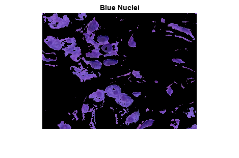 Figure contains an axes object. The axes object with title Blue Nuclei contains an object of type image.