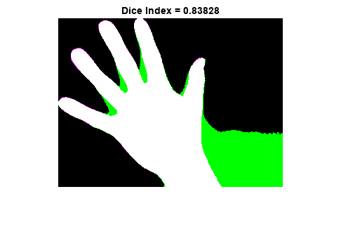 Figure contains an axes object. The axes object with title Dice Index = 0.83828 contains an object of type image.