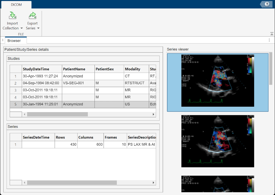 DICOM Browser app