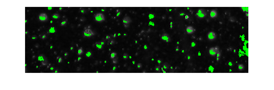Figure contains an axes object. The hidden axes object contains an object of type image.
