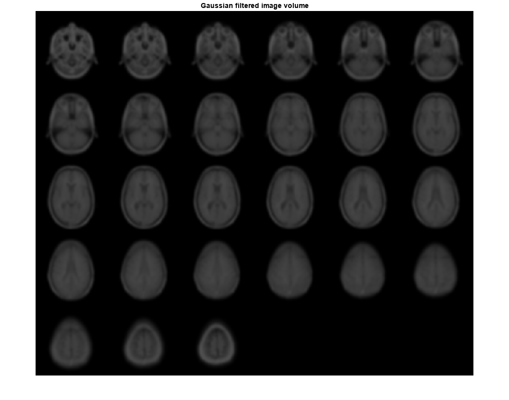 Figure contains an axes object. The axes object with title Gaussian filtered image volume contains an object of type image.