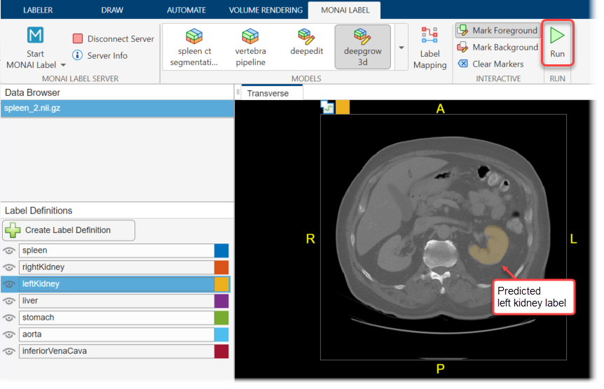 Medical Image Labeler app window, showing predicted left kidney labels in a transverse slice of a CT scan