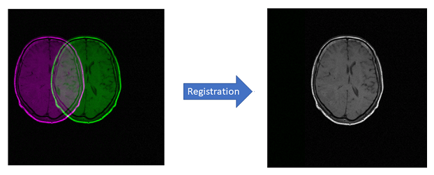 Translation Registration