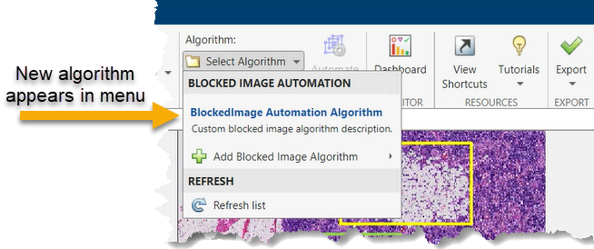 Add new algorithm to Select Algorithm menu.