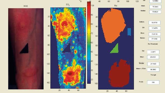 La Universidad de Nottingham y AstraZeneca Research and Development Charnwood aceleran la investigación clínica de fármacos antiinflamatorios