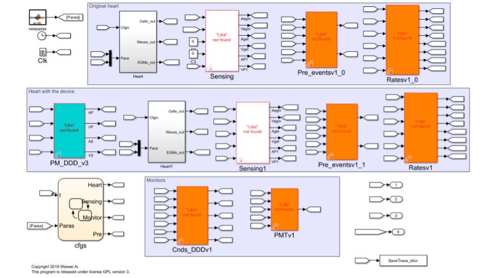Ejemplo de modelo de medicina in silico de corazón electrofisiológico con marcapasos.